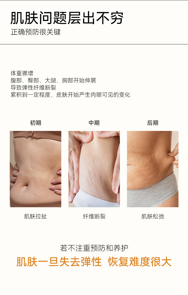 【香港直邮】 福来 抚纹滋养护理乳125ml|橄榄油+泛醇+玻尿酸多维淡纹!紧致滋润保湿补水|缓解孕期肌肤紧绷干痒