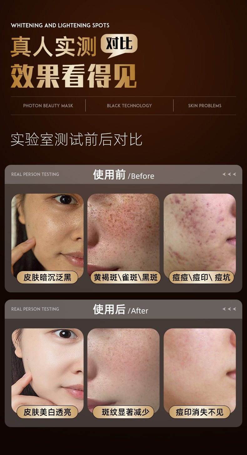 香港直送】O'Quellin フォト若返りフェイシャルマスク美容機器